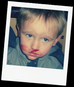 blood 061 257x300 Nose Bleed For No Reason In Children; Kaidens Morning 