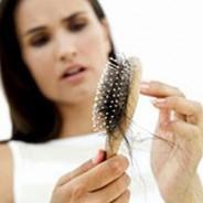 Top Hair Loss Causes and Preventions