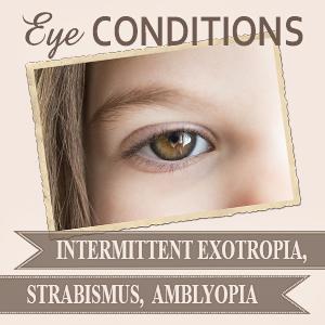 Intermittent Exotropia