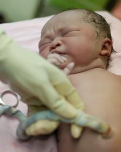 Newborn Baby after Delivery 
