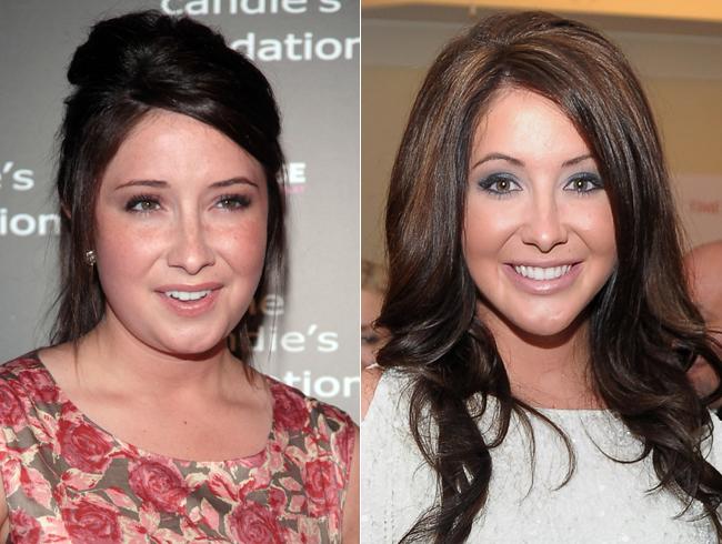 Bristol Palin plastic surgery