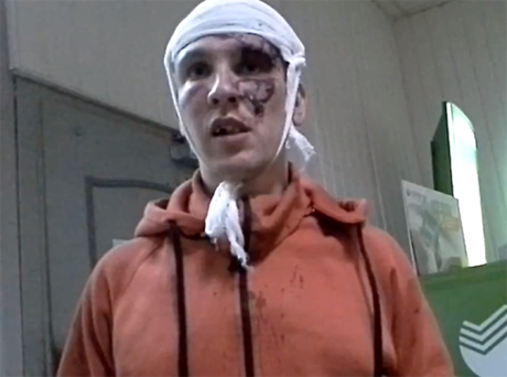 Chernogubov in the hospital, post assault. YouTube screenshot. May 23, 2013.