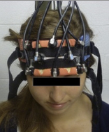 Long-term improvement of brain function and cognition with brain stimulation and cognitive training.
