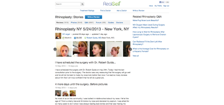 Rhinoplasty NY 5:24:2013 - New York, NY - Rhinoplasty review - RealSelf
