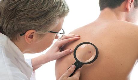 Guide to Skin Cancer Cure
