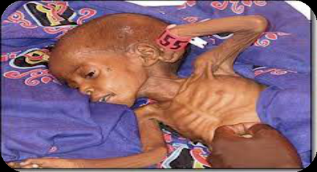 images Should Starving Children Adverts Be Banned?