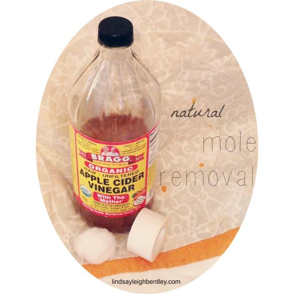 mole removal header