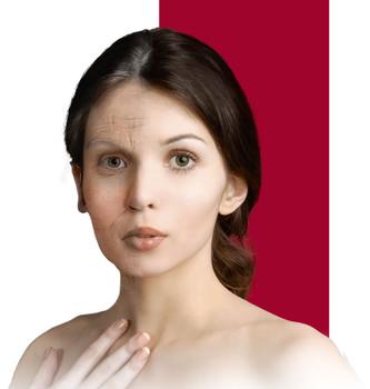 Fytofontana Cosmeceutical alternative to Botulotoxin injections Fytofontana Cosmeceutical alternative to Botulotoxin injections2