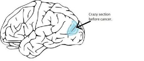 Delayed onset crazy. Is that a thing? crazy