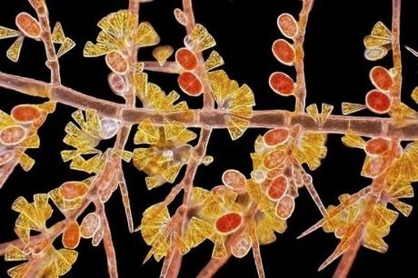 arlene-wechezak-snapped-this-image-of-red-algae-the-image-shows-its-reproductive-machinery