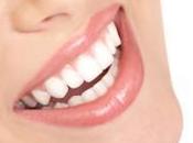 Home Remedies Shiny White Teeth You’ve Never Heard