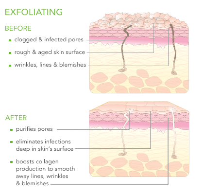  photo Exfoliate_zps33fa0805.png