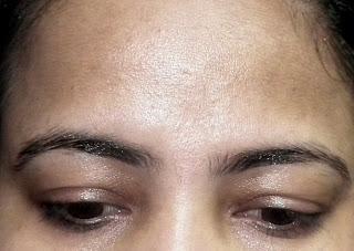 My Oily/Sensitive Skin in Summer and Monsoon - Details of Pores, Crow's Feet, Wrinkles