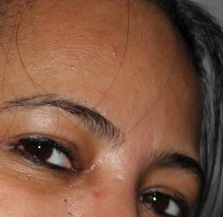 My Oily/Sensitive Skin in Summer and Monsoon - Details of Pores, Crow's Feet, Wrinkles