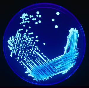 Legionella sp. colonies growing on an agar pla... Legionella sp. colonies growing on an agar pla...