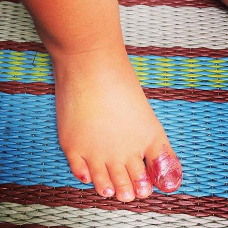 I just caught Emma painting her own toenails.  In an attempt to look pretty, it now looks like her big toe was run over by the lawn mower.