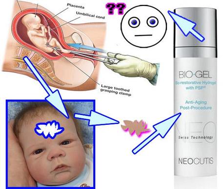 Anti Aging Cream Uses Aborted [14 Week] Male Fetus as Active Ingredient.