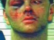 Indicted Stomping Handcuffed Head (Videos)