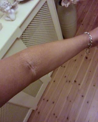 Review - Tough Stuff Tan Remover By Cocoa Brown WARNING Some Seriously Bad Tanning Pictures!