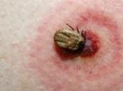 Recommends Community Approach Fighting Lyme Disease