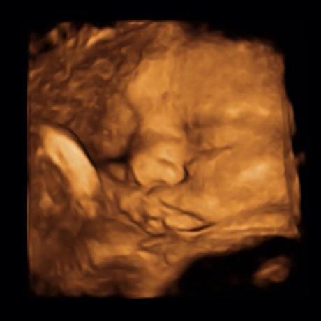 36 Week Bumpdate! 36 Week Bumpdate!