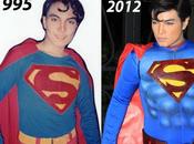 Crazy 35-Year Surgeries Look Like Superman