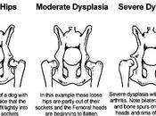 Basic Information About Dysplasia