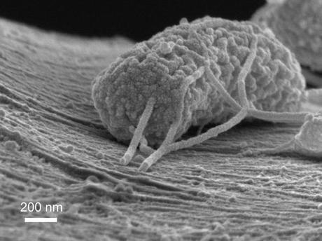The tubular growth depicted here is a type of microbe that can produce electricity. Its wire-like tendrils are attached to a carbon filament. This image is taken with a scanning electron microscope. More than 100 of these 'exoelectrogenic microbes' could fit side by side in a human hair. (Credit: Stanford Engineering / Xing Xie)
