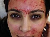 Weird Beauty Secrets Kardashian's Bloody Vampire Facial