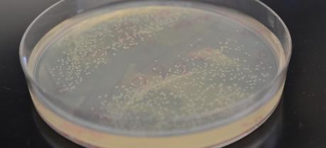 Colonies of E. coli genetically modified with the new pathway. (Credit: UCLA)