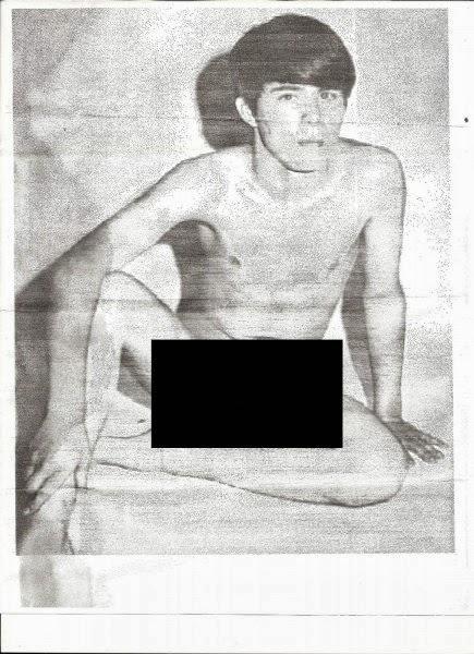 Photos Seem To Show That Bill Pryor Has Eye Condition That Was Present In Young Man Featured At Gay Porn Site