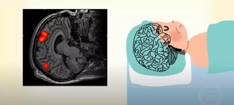 Midazolam and Ketamine Midazolam and Ketamine