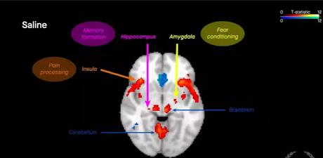 Functional MRI analysis Functional MRI analysis