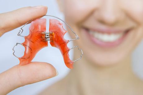 Tips for maintaining orthodontic retainers-mongersmint