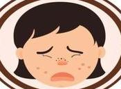 Ayurveda Treatment Skin Rashes Itching