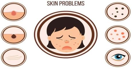 Different Types of Skin Problems