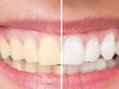 Don’ts Teeth-Whitening