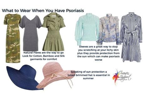 What to Wear When You Have Psoriasis