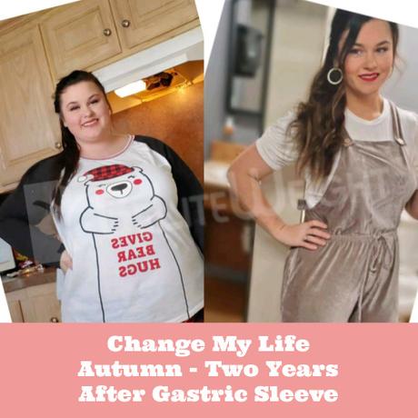 Change My Life – Autumn Two Years After Gastric Sleeve