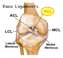 PCL Sprain: Your Complete Guide