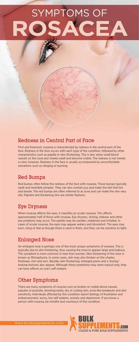 Rosacea Symptoms