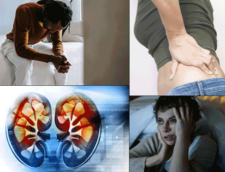 What is Chronic Kidney Disease? – Treatment through Ayurveda