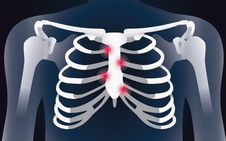 A Sharp Pain Under Right Breast – Special Health Guide