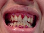 Vitamin Necessary Humans?