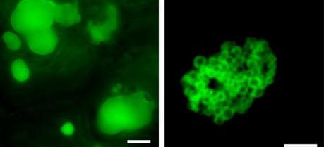 Increasing oil accumulation in leaves: Overexpressing the gene for PDAT, an enzyme involved in oil production, caused plant leaves to accumulate large amounts of oil in large globules (left). When the scientists also added a gene for olesin, a protein known to encapsulate oil droplets (fused to green fluorescent protein to confirm its location), clusters of smaller, more stable oil droplets formed (right). (Credit: Brookhaven National Laboratory)