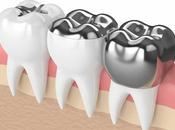 Dental Filling Material Market Booming with Highest CAGR Upcoming Period 2021 2026