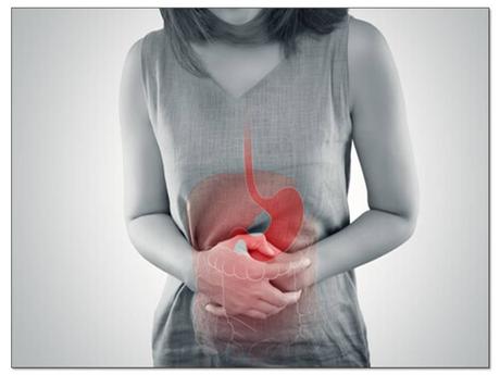 Natural Cure for Ulcerative Colitis