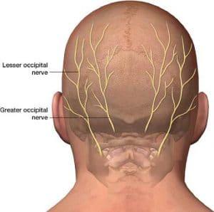 Craniocervical Instability Ehlers Danlos Syndrome