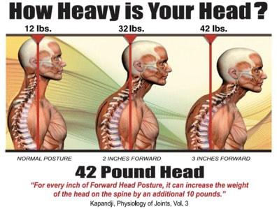 Craniocervical Instability & Ehlers Danlos Syndrome: Know the Facts