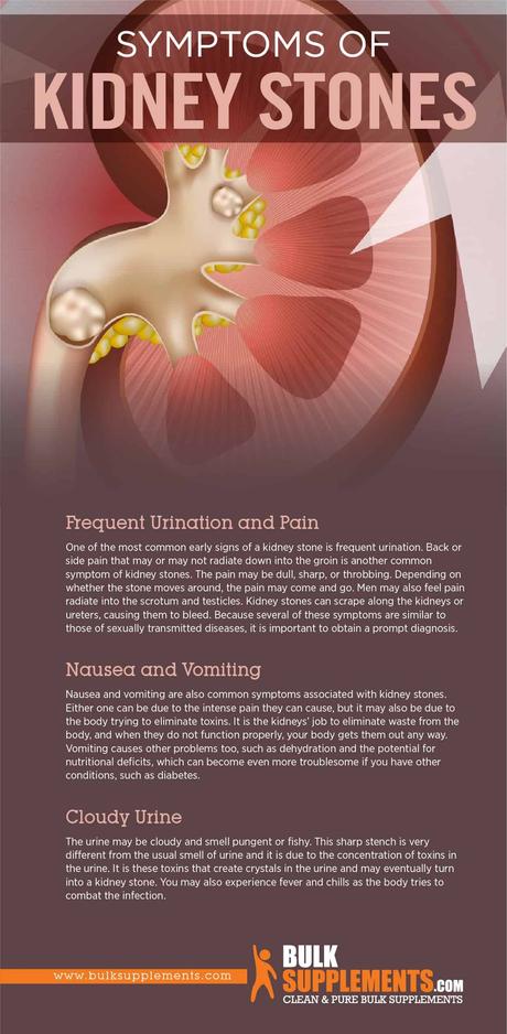 Symptoms of Kidney Stones